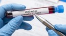 Setze morts i un centenar de nous casos confirmats de coronavirus a la demarcació de Tarragona
