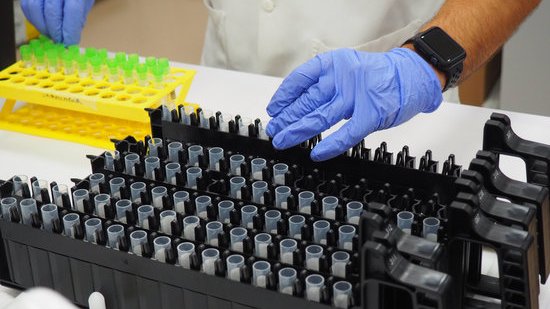 Pla obert de diverses mostres PCR a punt per entrar a la nova màquina que permet processar més ràpidament al laboratori de l'ICS Girona. Imatge cedida a l'ACN el 2 d'octubre de 2020