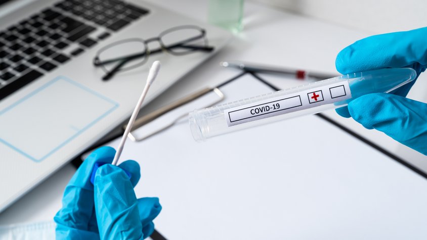 Simón considera un "risc" les autoproves PCR si no hi ha personal sanitari