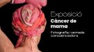 Xerrada i exposició sobre el càncer de mama al Museu Deu 